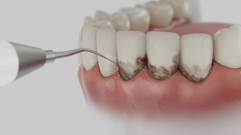 Reliable Dental Implants contractor in Rocky Ford, CO by Smile Center Dentistry